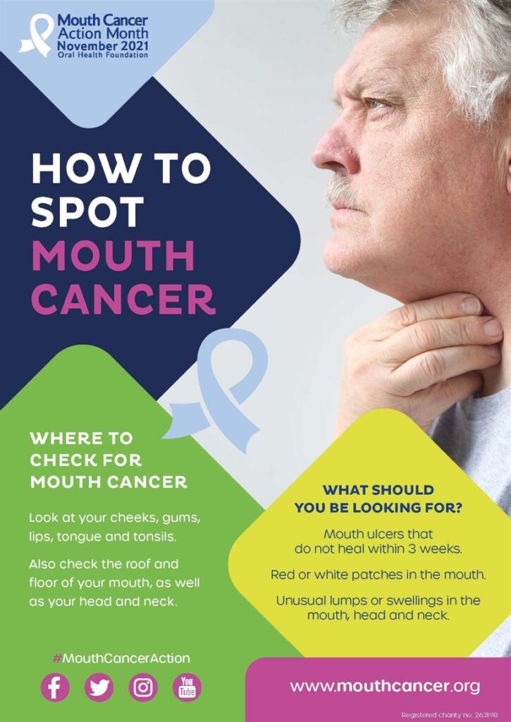 How to spot mouth cancer