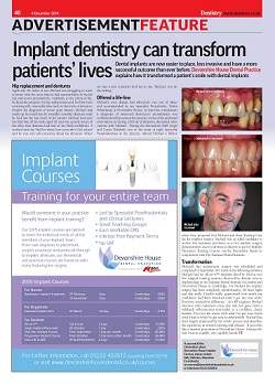 Press article about implant dentistry