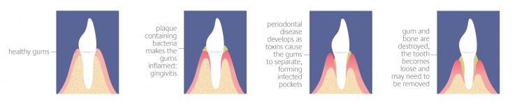 Periodontic Images