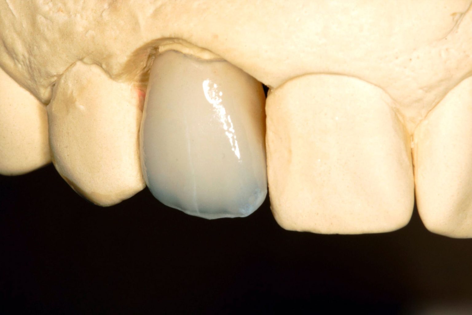 Lab Docket Labdent Dental Laboratory • Devonshire